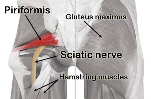 https://bestperformancemt.massagetherapy.com/images/Hip%20Muscle%20Anatomy.jpg